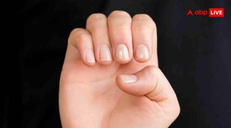 नाखूनों से पहचानें सेहत का हाल, ये संकेत हो सकते हैं खतरनाक, तुरंत लें मेडिकल सलाह