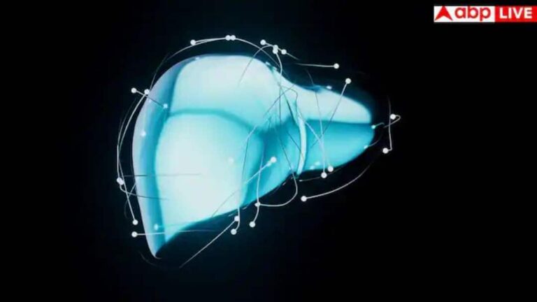 Fatty Liver Disease: सिर्फ शराब ही नहीं, आपकी खराब लाइफस्टाइल भी बना रही है लिवर को बीमार; जानें कैसे बचें?